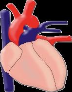 Κλινικές εκδηλώσεις Καρδιαγγειακό Σύστηµα Υπέρταση, υπερτροφία αριστερής