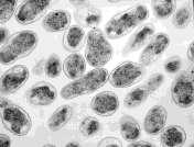 Brucella abortus. Συνήθως είναι παθογόνος, προκαλεί αποβολή των αγελάδων, έχει άριστη θερμοκρασία ανάπτυξης τους 37 C και εύρος από 20-40 C. ΕΙΚΟΝΑ 4. Brucella abortus Πηγή: http://www.kodomo.cmm.msu.