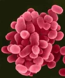 Brucella melitensis Πηγή: http://biogefahr.shopkeeper.de/ 2.3.