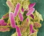 ΕΙΚΟΝΑ 6. Esherichia coli Πηγή: http://www.cdc.gov/ecoli/ 2.3.2. Γένος Salmonella Περιλαμβάνει παθογόνους μικροοργανισμούς για τον άνθρωπο και τα ζώα.