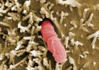 ΕΙΚΟΝΑ 10. Yersinia pseudoturberculosis Πηγή: http://www.lookfordiagnosis.com/ ΕΙΚΟΝΑ 11. Yersinia enterocolitica Πηγή: https://www.pathologyoutlines.com/ 2.4.