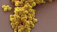 2.7.1. Γένος Streptococcus Περιλαμβάνει γένη που χαρακτηρίζονται από σφαιρικά ή ωοειδή κατά ζεύγη, τετράδες ή αλυσίδες διαφόρων μεγεθών.