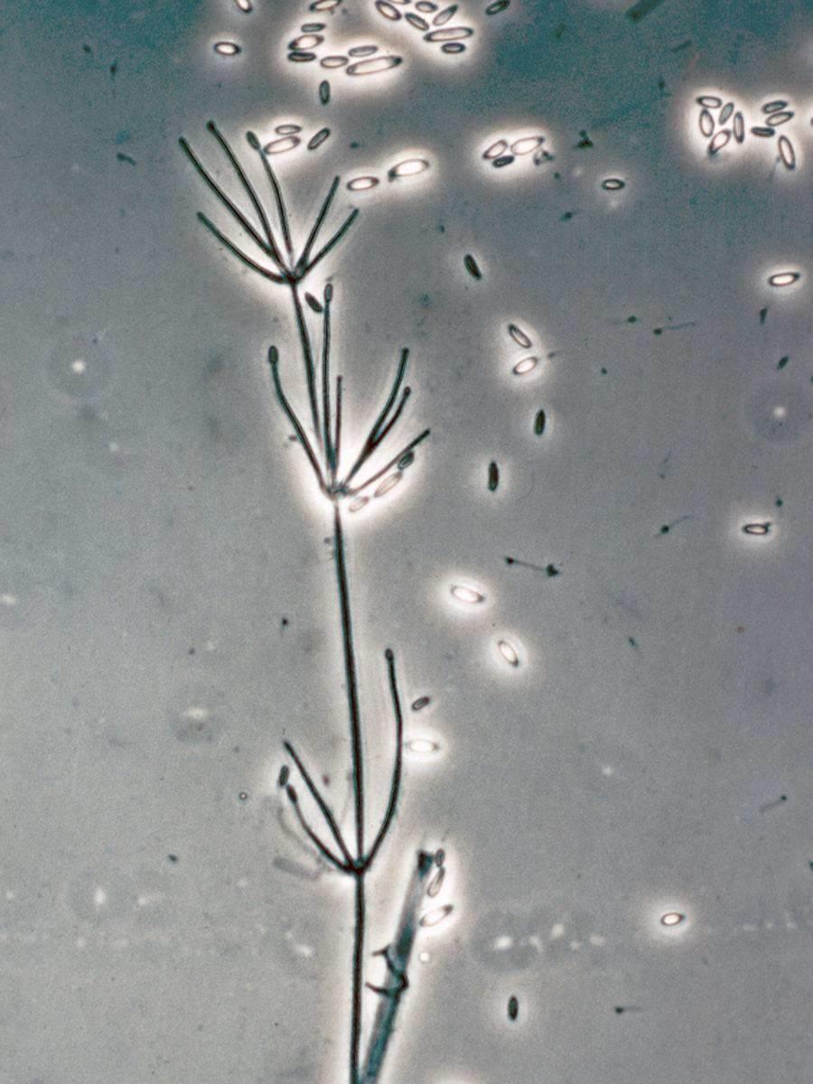 Εικόνα 8: Κονιδιοφόροι με κονίδια του μύκητα Verticillium dahliae, (www.docplayer.gr). Τα κονίδια είναι μονοκύτταρα, υαλώδη, ωοειδή μέχρι ελλειψοειδή, διαστάσεων 2,5-8μm x 1.4-3.2μm.