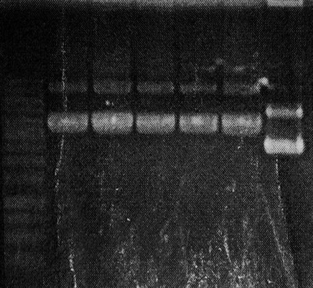 Ladder L2 200 L2 2001 L2 2002 L2 3001 L23002 1226 Εικόνα 33: Η φωτογραφία του gel του πρωτοκόλλου των mini preps δείχνει την πιθανή ενσωμάτωση του γονιδίου VdlaeA μέσα στο φορέα SK1226.