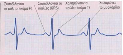 2.3 Ηλεκτροκαρδιογράφημα (ΗΚΓ) Το ηλεκτροκαρδιογράφημα καταγράφει την ηλεκτρική δραστηριότητα των μυών της παλλόμενης καρδιάς αποδίδοντας μέσω του ηλεκτροκαρδιογράφου σε ειδικό χαρτί ή ψηφιακή οθόνη,