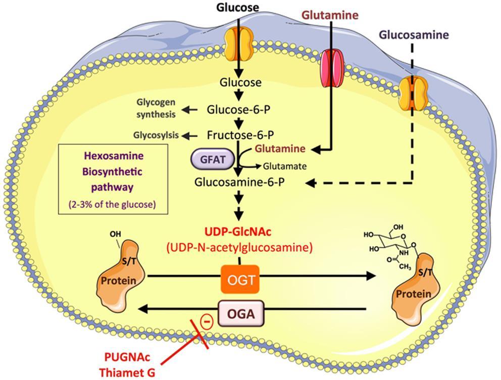 Ενεργοποίηση παθογενετικής οδού εξοσαμίνης Υπεργλυκαιμία Γλυκόζη Fructose-6-phosphate GFAT Glucosamine-6-phosphate UDP-N-acetylglucosamine Γλυκοζυλίωση της σερίνης