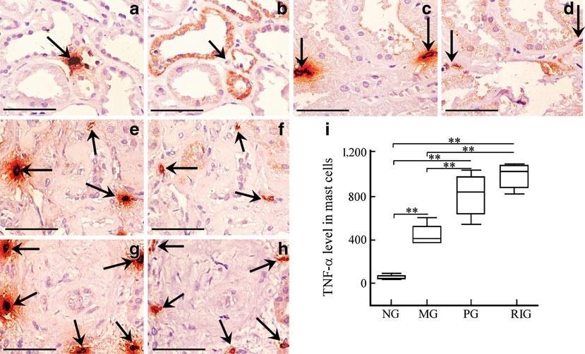 Diabetologia 2012;55:801 811 Μαστοκυττάρων