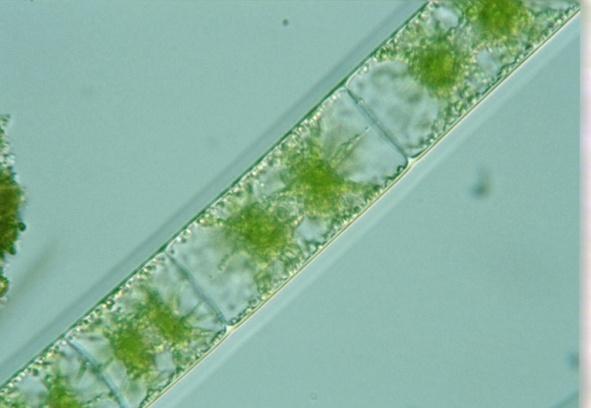 Κατά τη διάρκεια της σύζευξης τα νήματα αλλάζουν χρώμα από φωτεινό πράσινο σε καφετί. Εικόνες 2.6 α,β. Το γένος Zygnema στο μικροσκόπιο (http://jcoll.org/genoma/vida_microsubmarina/microalgas/zygnema.