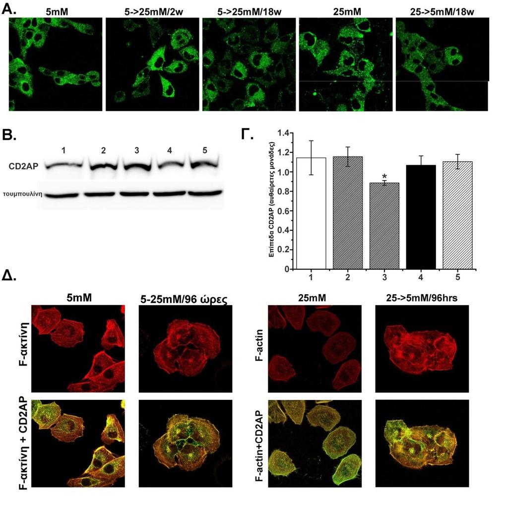 Παρά το γεγονός αυτό, τα επίπεδα της CD2AP στα HGEC:25mM είναι αντίστοιχα με αυτά των HGEC:5mM (Σχήμα 10Β).