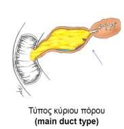 12 Papillary Mucinus Neoplasms, MDT-IPMN), νεοπλάσματα τύπου παράπλευρων πόρων (Branch Duct Type-Intraductal Papillary Mucinus Neoplasms, BDT-IPMN) ή σε συνδυασμένου τύπου.