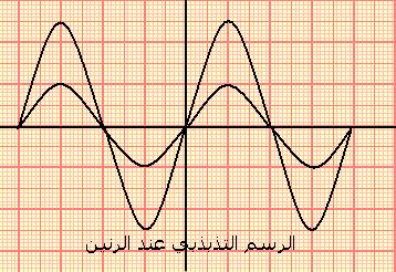 ω πn f( ω) Z f(n) + ( Lω ) Lω L ω ω LC N N π LC تكون قصوية عندما تكون الممانعة Z دنوية أي قصوية بالنسبة