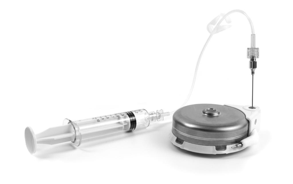 Instructions Aspirating the Intrathecal Catheter English Catheter Access Aspiration Setup 6. Refer to the patient s chart or implant card for implanted catheter volume. Then, add 0.