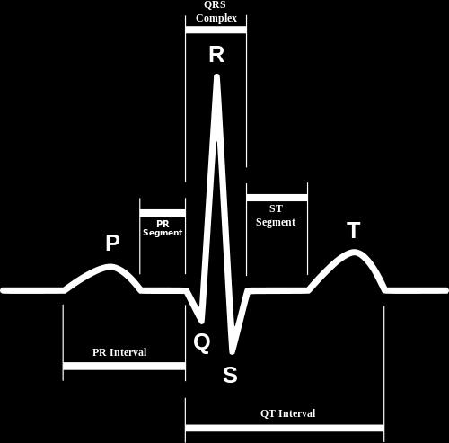 7. irudia: EKG-ren deribazioak 2.4. EKG normala Elektrokardiograma batek ondorengo ezaugarriak ditu bihotzaren taupada arrunt bat erregistratzen denean: P uhina, QRS konplexu edo gunea, eta T uhina.