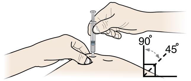 Etapa 3: Injectaţi A ŢINEŢI în continuare pielea între degete.