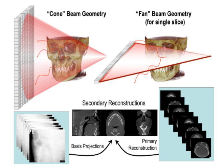 Cone beam CT (υπολογιστικός τομογράφος κωνικής δέσμης) «Κλασικός» υπολογιστικός