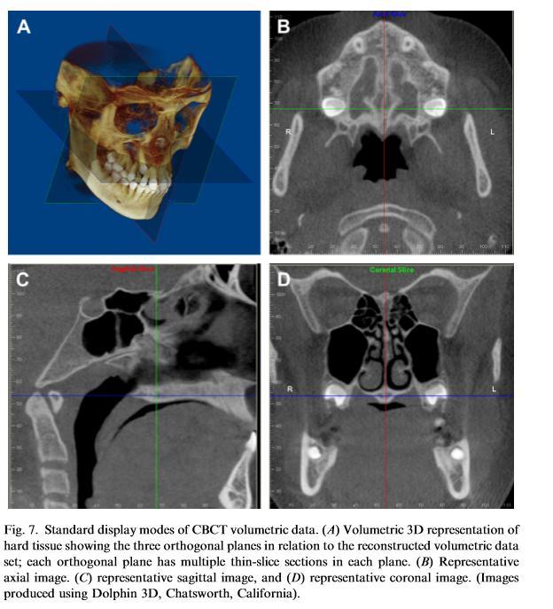 Cone beam CT