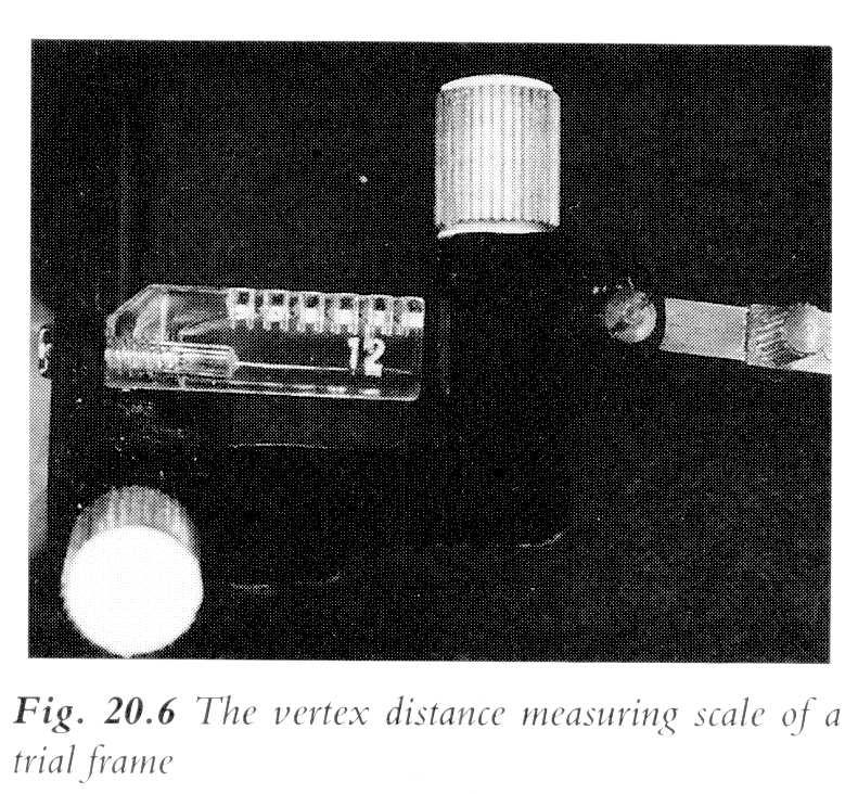 Medida da distancia de vértice Distinguiremos 3 situacións: Medida durante a refracción: Se a refracción se realiza con foróptero, este incorpora un visor para facer a medida.
