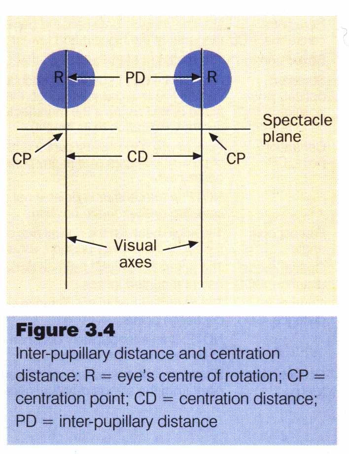 Medidas faciais Definicións Plano da armazón: Plano que contén os aros da armazón. aproximada).