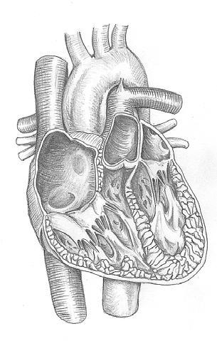 MUUD SÜDAME-VERERINGE HAIGUSED Hüpertroofiline kardiomüopaatia südame vasaku vatsakese lihaselise seina paksenemisega kulgev haigus.