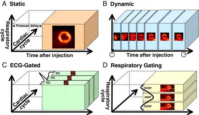 38 Εικόνα 11: Οι 3 διαστάσεις πέρα από το 3D PET (μεταβολή στην πρόσληψη του ραδιοφαρμάκου, καρδιακός κύκλος, αναπνευστικός κύκλος) Στο στατικό 3D PET, οι καταγραφές των γεγονότων (εξαϋλώσεων) και οι