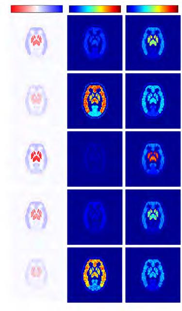 63 2.6.1. MATTHEWS et al. 2010 Οι Matthews et al (Matthews 2010) χρησιμοποίησαν ένα 2D ψηφιακό ομοίωμα εγκεφάλου για να προσομοιώσουν εξέταση με [ 11 C]diprenorphine.