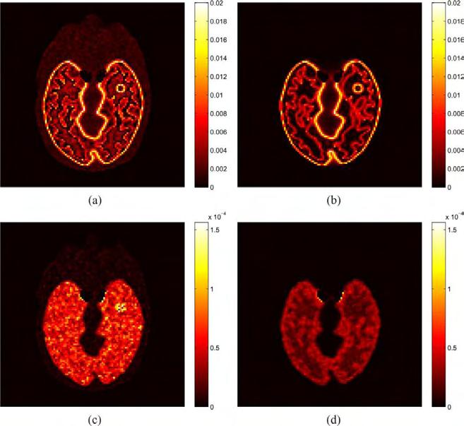 67 2.6.4. WANG AND QI 2012 Σε αυτήν την εργασία οι Wang και Qi (Wang 2012) μελέτησαν μία εξέταση εγκεφάλου με 18 F-FDG χρησιμοποιώντας μία τομή από το ομοίωμα Zubal (Zubal 1994).