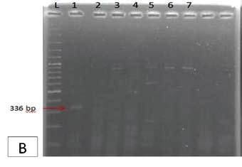 - Fig1. PCR results for detection of PVY (A) from potato Sprout tips c.v Chandramukhi after treatment with: Azacitidine (AZA) and PLRV (B) by using Ribavirin (RBV): L: ladder. 1: control.