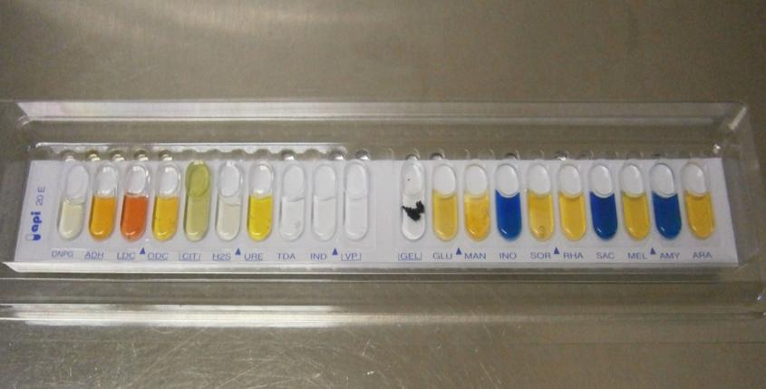 12 Μικροβιακό Φορτίο Διαδικασία