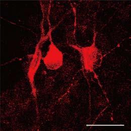 (b-d Double immunostaining for Nestin (green and Ki67 (red with DAPI