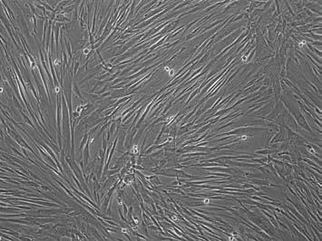 episomal vector.