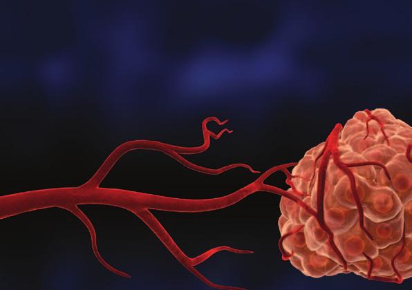 Šta je to rak i kako deluje Sutent? PDGFR α,-β VEGFR-1, -2, -3 PDGFR α,-β VEGFR-1, -2, -3 Zajedničko za sva oboljenja raka je da se izvesni tipovi ćelija dele nekontrolisano.