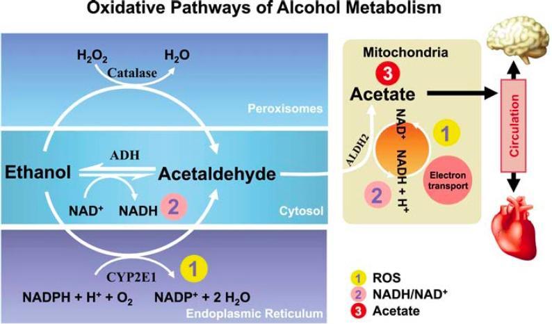 ACIDOZE METABOLICE CU DEFICIT ANIONIC CRESCUT CETOACIDOZA ALCOOLICĂ Alcoolismul cronic determină acidoză prin: 1.