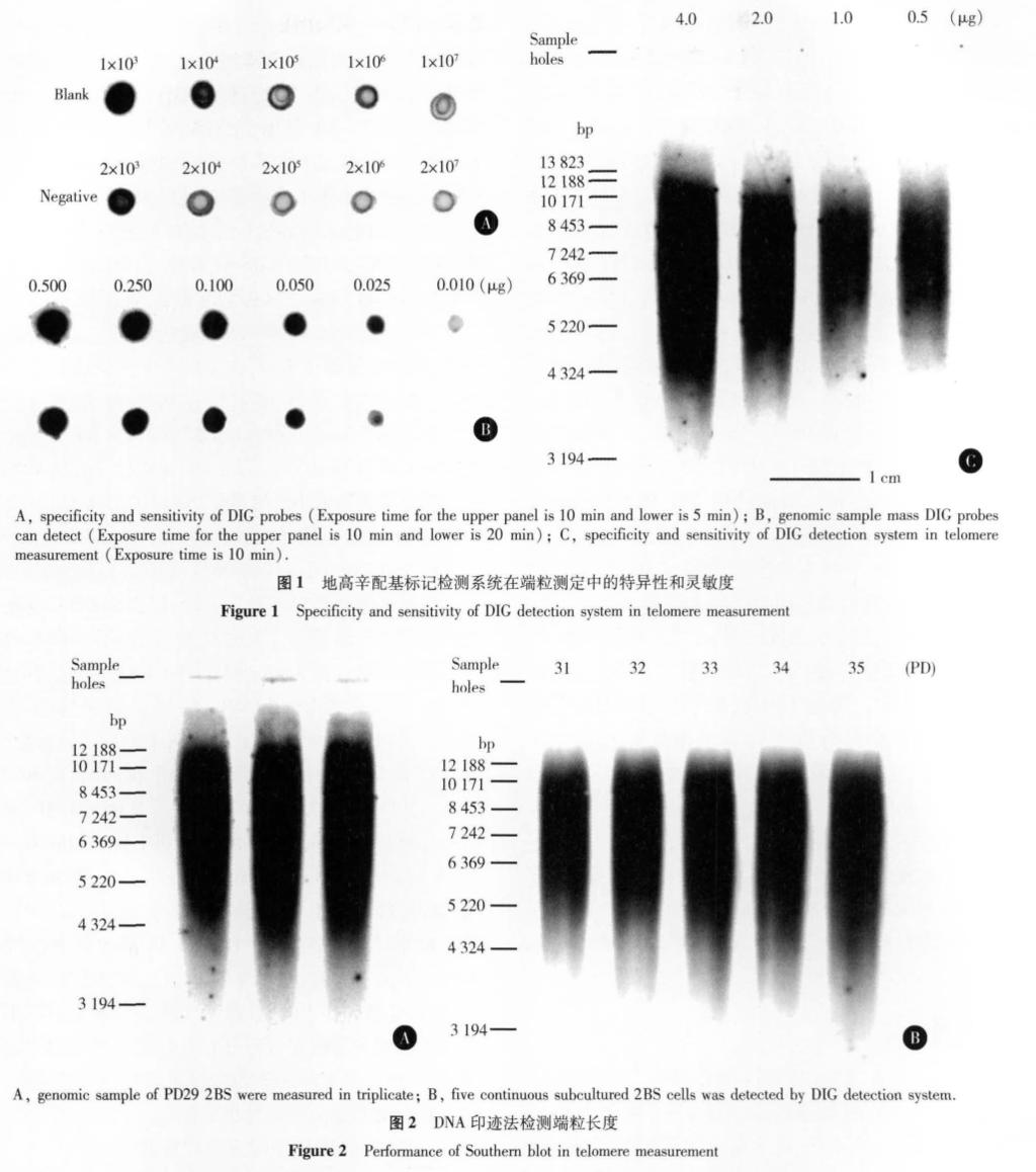 300 PCR 16. 57 5. 06% 17. 53% 6. 12% T /S ΔCt 9. 57% T /S PD31 PD36 F = 0. 97 P = 0. 38 DNA PD36 PD41 F = 2. 02 P = 0.