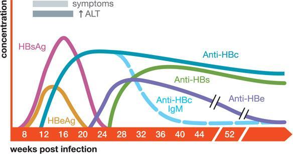 Хроничната вирусна инфекција се карактеризира со јасно изразени симптоми на црнодробна инфламација кога се присутни изнемоштеност, замор и артралгија. 4 Слика 4.