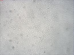 ribjimi celicami (ZFL) -gre za poskuse, ki so narejeni izven organizma, na nekem izoliranem sistemu Prednosti: -navadno imajo višjo občutljivost kot in vivo poskusi -natančnejša izpostavitev -celični