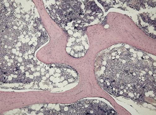 Οστά Το εσωτερικό (ακανόνιστο) οστό, επίσης γνωστό ως δοκιδωτός ή σπογγώδης οστικός ιστός είναι ένα πορώδες δίκτυο κυττάρων.