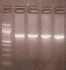 Εικόνα 38 Ηλεκτροφόρηση των προϊόντων της PCR της IL-1B (+3953) σε πηκτή αγαρόζης 1,5% Διαδρομή 1-4: προϊόντα της PCR, διαδρομή Μ: Marker (100 bp DNA ladder) Μ 1 2 3 4 731 bp Γ) Πέψη με περιοριστικό