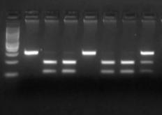 Εικόνα 43 Παραδείγματα πολυμορφισμών του γονιδίου της IL-1Β (-511) σε πηκτή αγαρόζης 3,5% 2,3,5,6: CC γονότυπος, 7: CT γονότυπος, 1,4: TT γονότυπος Μ: Marker (100 bp DNA Ladder) M 1 2 3 4 5 6 7 304