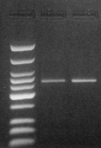 Εικόνα 45 Ηλεκτροφόρηση των προϊόντων της PCR της IL-2 (+114) σε πηκτή αγαρόζης 2% Διαδρομή 1-2: προϊόντα της PCR, διαδρομή Μ: Marker (low molecular weight DNA ladder) Μ 1 2 262 bp Γ) Πέψη με