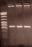 με το μέγεθος των ζωνών του marker PBR 322 DNA Msp I Digest (BioLabs, 2,5 μl + 3 μl πυκνή) (εικόνα 48). Το προϊόν της PCR ήταν το αναμενόμενο, στα 169 bp.