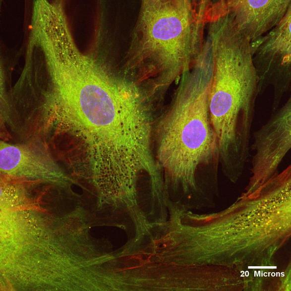 TKIVNI INŽENIRING S 3D NOSILCI Mezenhimalne zarodne celice Enostavna izolacija iz različnih tkiv kostni mozeg!