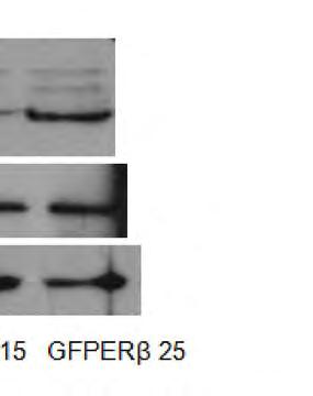 Κυτταρικά εκχυλίσματα ίσο N2a-GFPERβ αποικία ου πρωτεϊνικού περιεχομένου από Ν2a-GFP 25, ηλεκτροφορήθηκαν σε 10% P αποικία 15, και SDS πηκτή πολυακρυλαμιδίου, μεταφέρθηκαν σε μεμβράνη νιτροκυτταρίνης