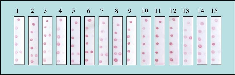 Τα αποτελέσματα γονοτυπικού προσδιορισμού των 30 χαρακτηρισμένων δειγμάτων βρέθηκαν σε πλήρη συμφωνία με τα αποτελέσματα που βρέθηκαν με μεθόδους αναφοράς (ARMS-PCR, Restriction Enzyme RE-PCR,
