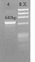 Οι εκκινητές που χρησιμοποιήθηκαν για την ενίσχυση τμήματος DNA (640 bp) που φέρει τη μετάλλαξη Hb Questembert ήταν, όπως και στη μεταλλαξιγόνο PCR, οι 5Ν και C2. Εικόνα 5.