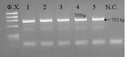 Εικόνα 5.43: Ηλεκτροφορήματα PCR προϊόντων μετά από mini-preps.