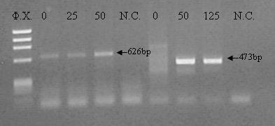 ΠΑΡΑΡΤΗΜΑ Β Βελτιστοποιήσεις στη μεταλλαξιγόνο PCR για τη σύνθεση τμημάτων DNA που φέρουν τις μεταλλάξεις Hb Heraklion, Hb Adana και Hb Questembert Μελέτη συγκέντρωσης DMSO Ο αρχικός σχεδιασμός της