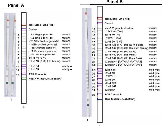 Εικόνα 3.5: Ταινίες ανίχνευσης μεταλλάξεων (Vienna Lab) που προκαλούν α- θαλασσαιμία, για Α) ελλείμματα και Β) σημειακές μεταλλάξεις. Α) Ταινία 1: φυσιολογικό δείγμα ελέγχου.