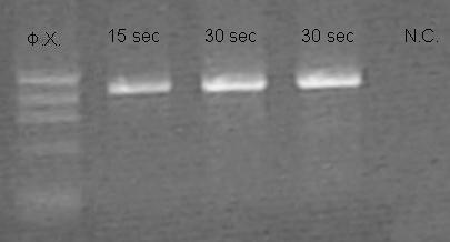 5 Μελέτη επίδρασης του χρόνου αποδιάταξης του DNA Για τη βελτιστοποίηση του χρόνου αποδιάταξης του DNA, πραγματοποιήθηκαν αντιδράσεις PCR με χρόνους αποδιάταξης 15 s, 30 s και 45 s (Εικόνα 5.5).