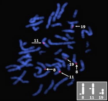 Kromosom 12 Kromosom 10 Kromosomi Y i X Humani