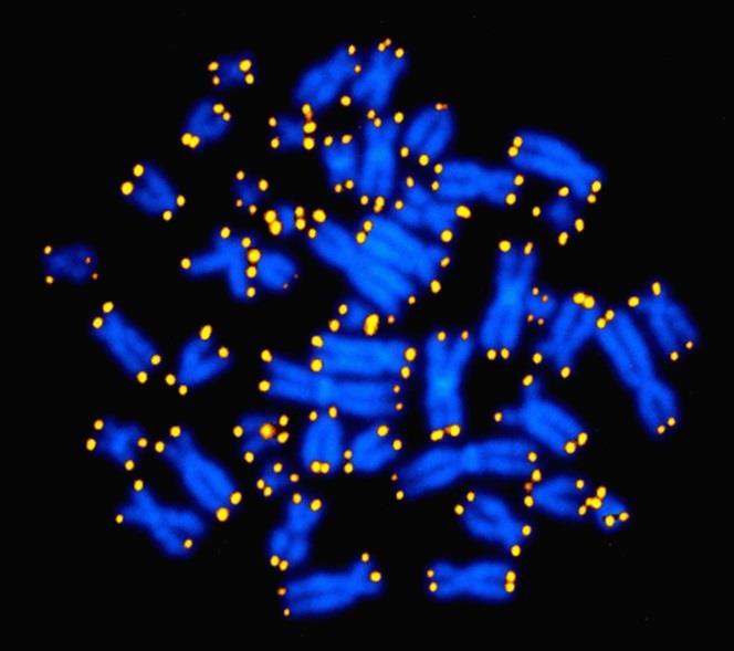(žuto) Humani kromosomi u metafazi, s genima